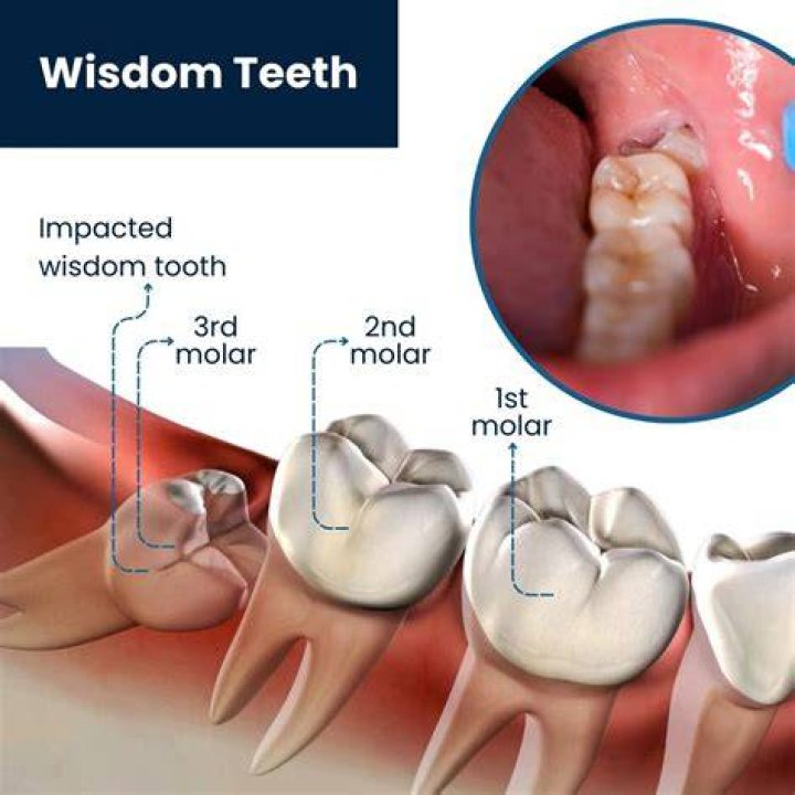 How do I stop my teeth from hurting when I run?