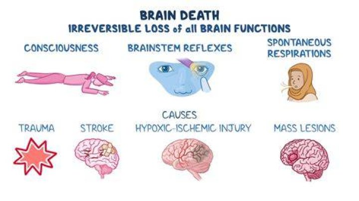How do you check for brain damage?
