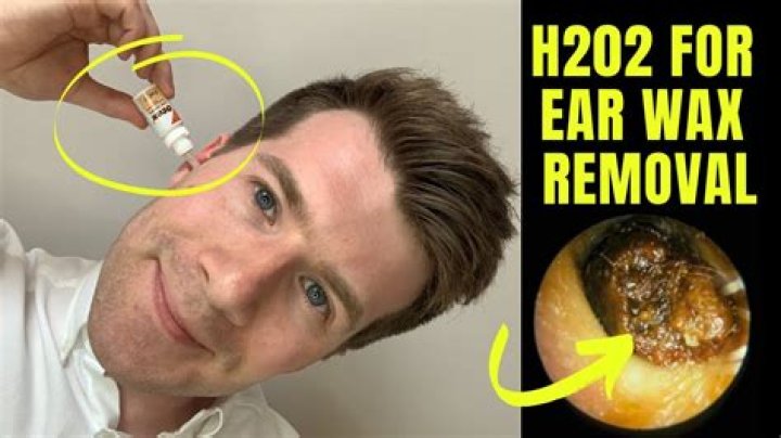 How do you get earwax out of your ear?