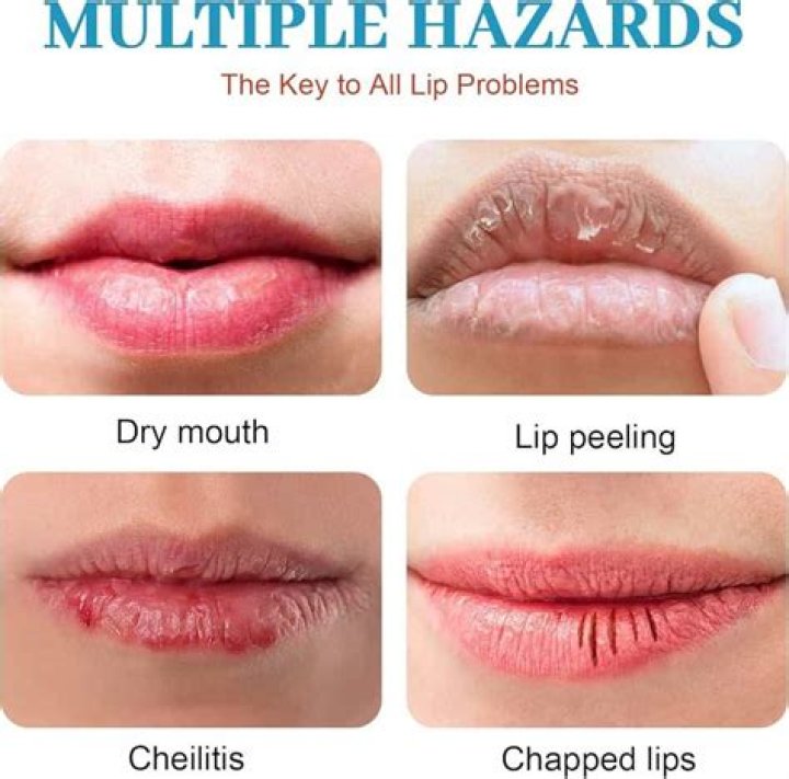 How do you know if your lips are healthy?