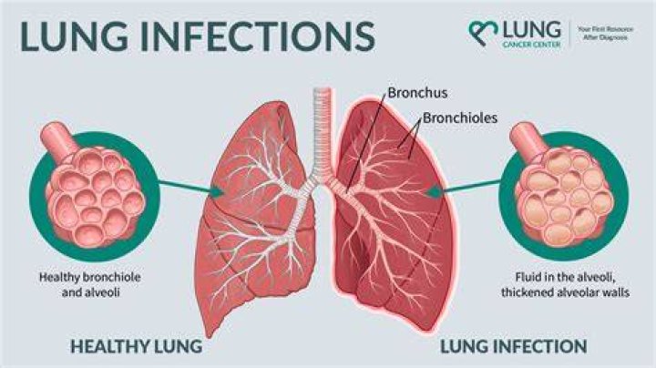 How do you know if your tongue has an infection?
