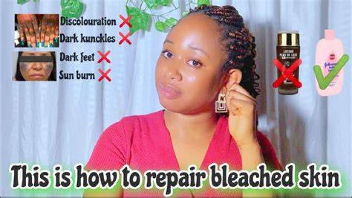 How do you repair bleached skin?
