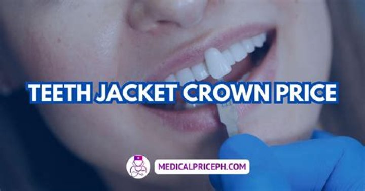 How is a dental jacket done?