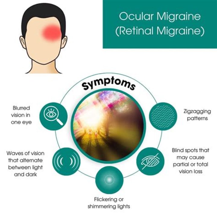 How long can a retinal migraine last?