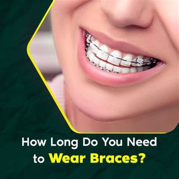 How long do you have to wear braces before jaw surgery?