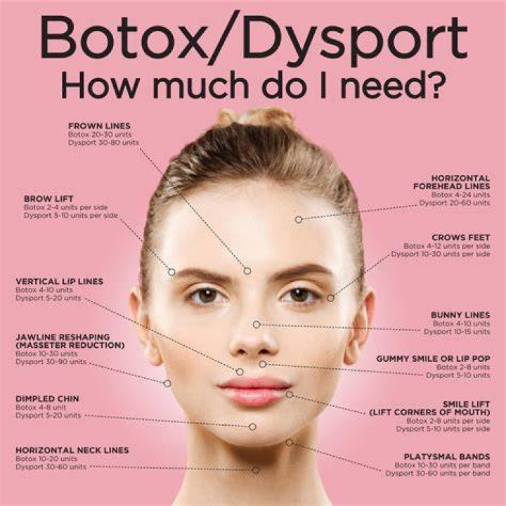 How long does Botox around mouth last?