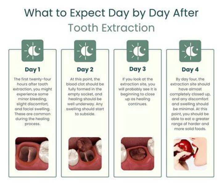 How long does face hurt after tooth extraction?