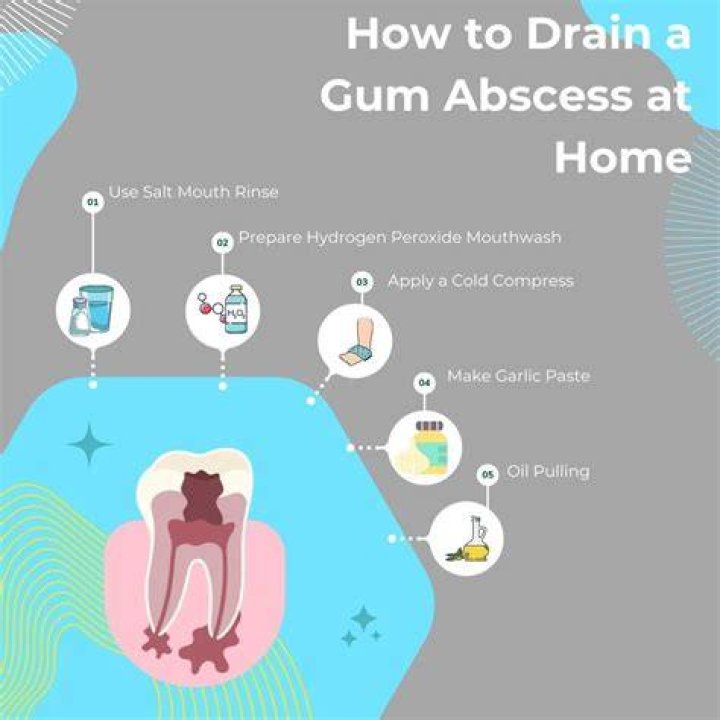How long does it take for a gum abscess to heal with antibiotics?
