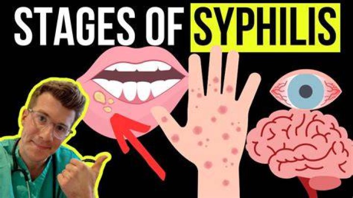 How long does it take to show signs of syphilis?