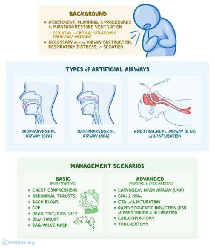 How Long Does your throat hurt after intubation?