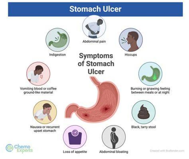 How much is a stomach transplant?