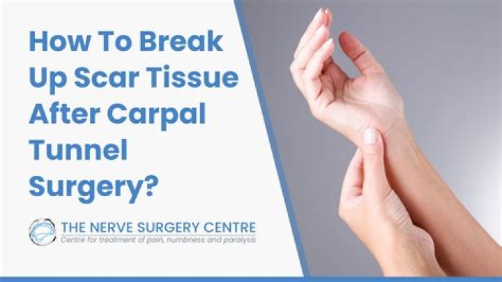 How painful is carpal tunnel surgery?