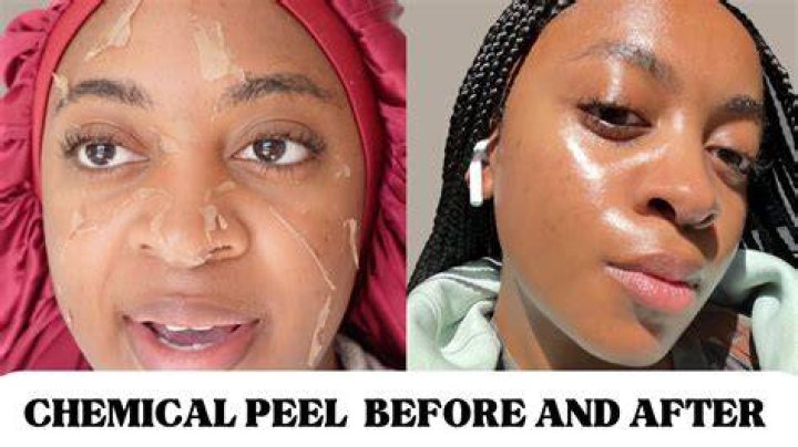 Is black skin more sensitive?