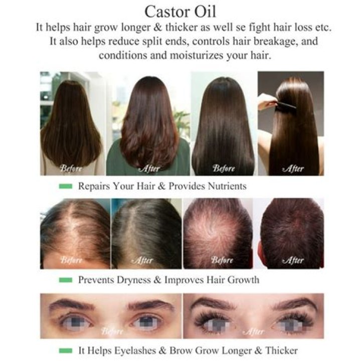 Is castor oil good for receding hair?
