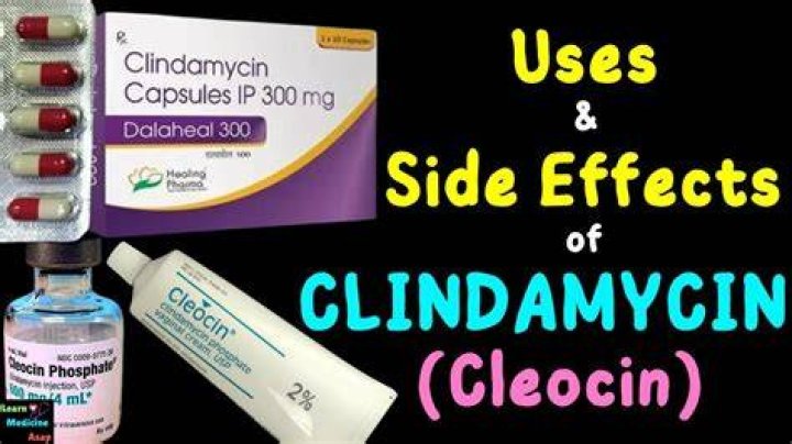 Is clindamycin good for boils?