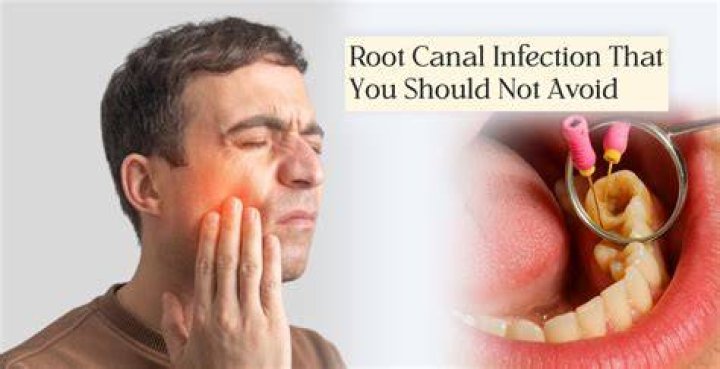 Is having a root canal redone painful?