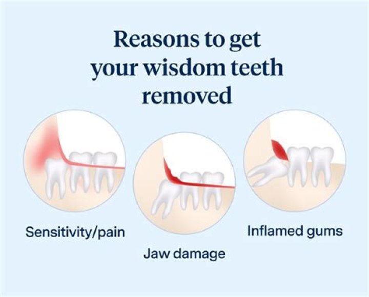 Is it normal to have pain 2 weeks after wisdom teeth removal?