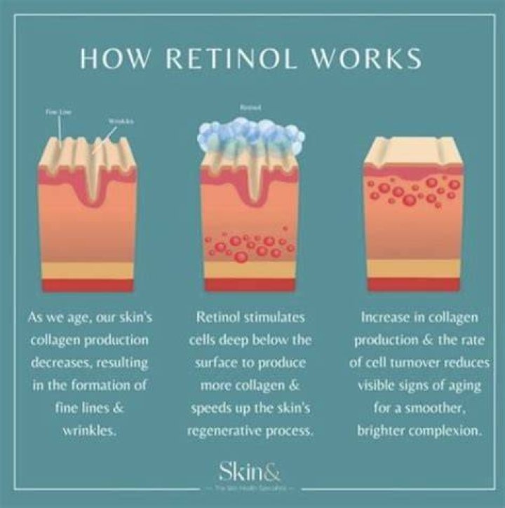Is retinol or glycolic acid better?