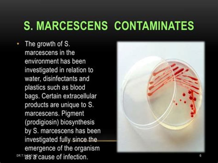 Is Serratia marcescens harmful to humans?