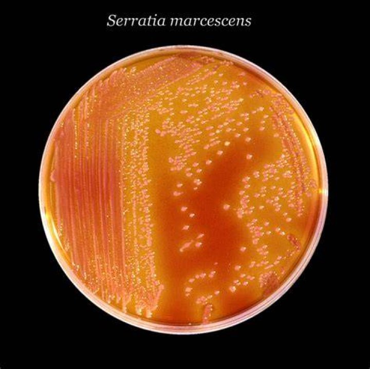 Is Serratia marcescens in water?