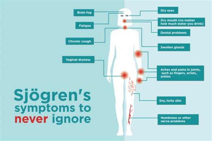 Is Sjogren's like lupus?