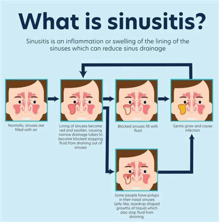 What's the difference between sinusitis and sinus disease?