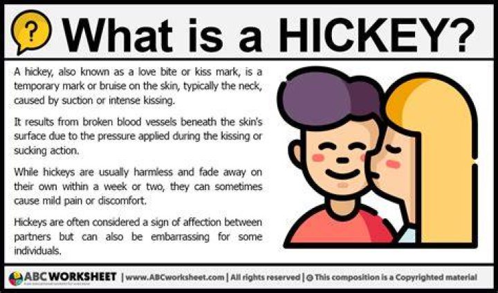 What are hickeys?