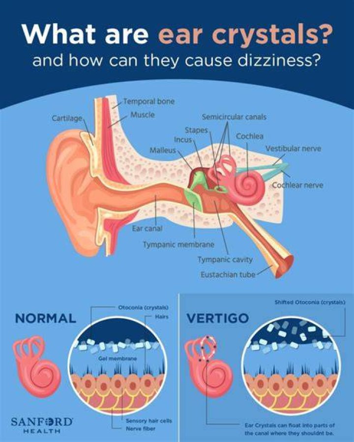 What are symptoms of crystals in the ear?