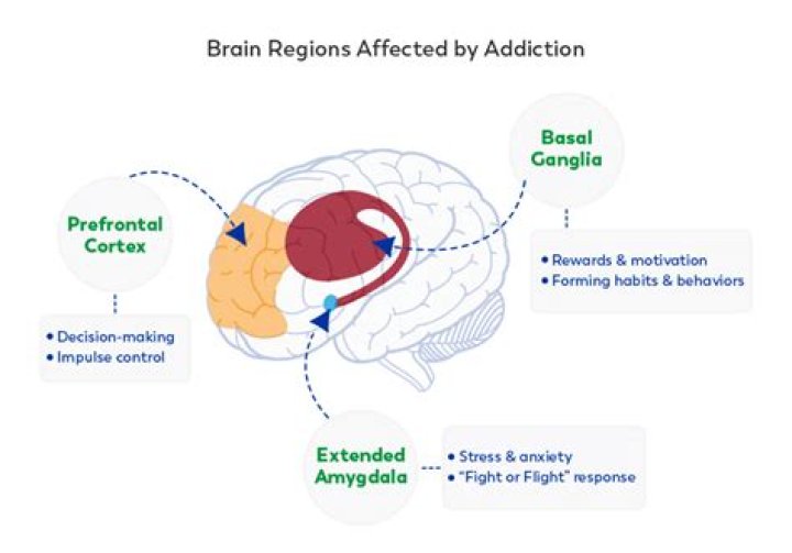 What are the 3 areas of the brain affected by addiction?