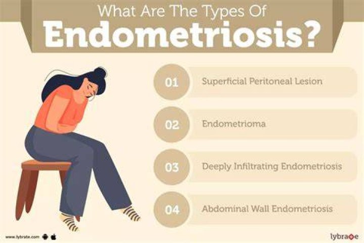 What are three signs of endometriosis?