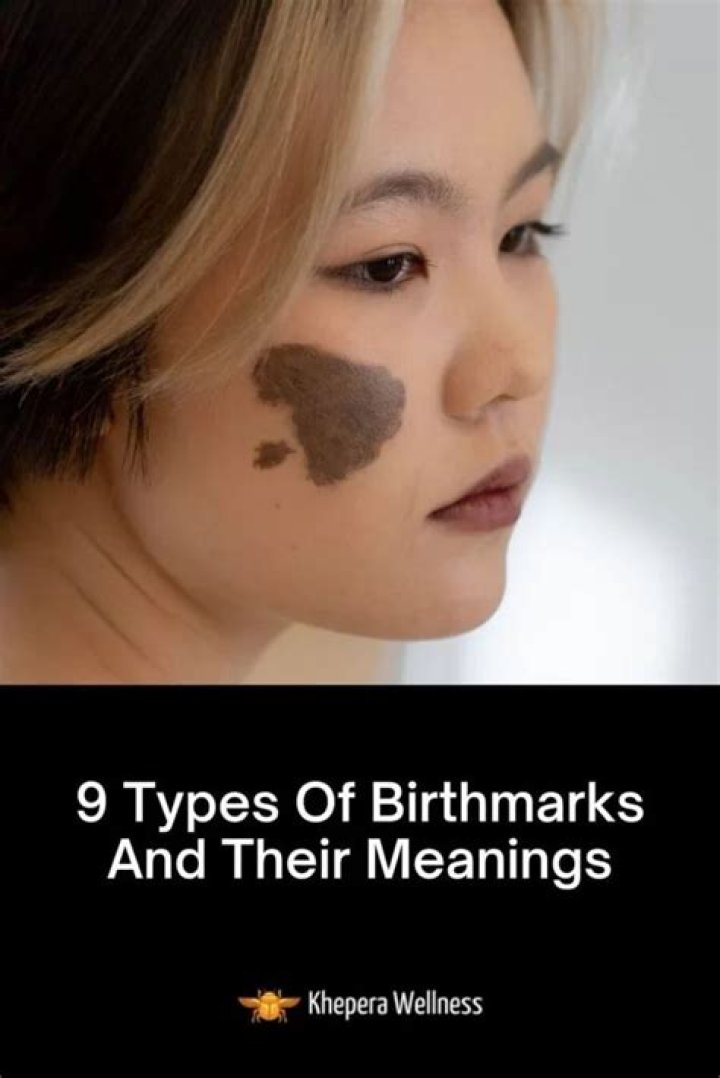 What creates birthmarks?