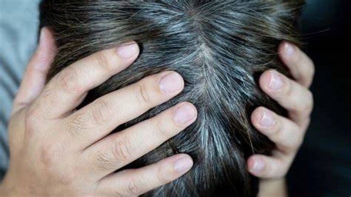What deficiencies causes GREY hair?