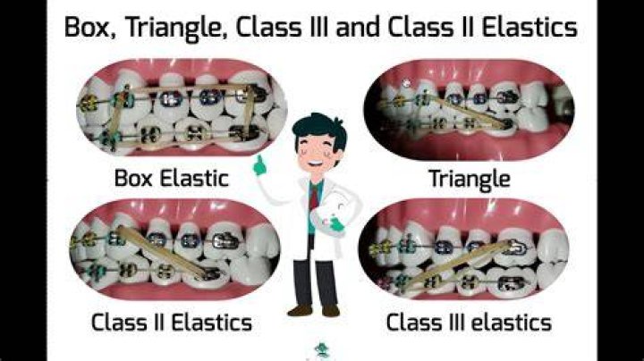 What do triangle elastics do?