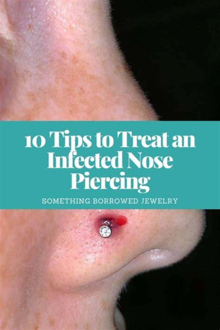 What does an infected nose piercing look like?