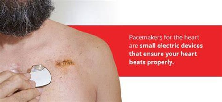 What does it feel like when your pacemaker goes off?