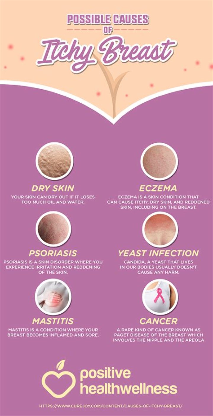 What does thrush on nipples look like?