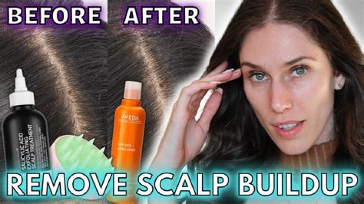 What happens if dead skin build up?