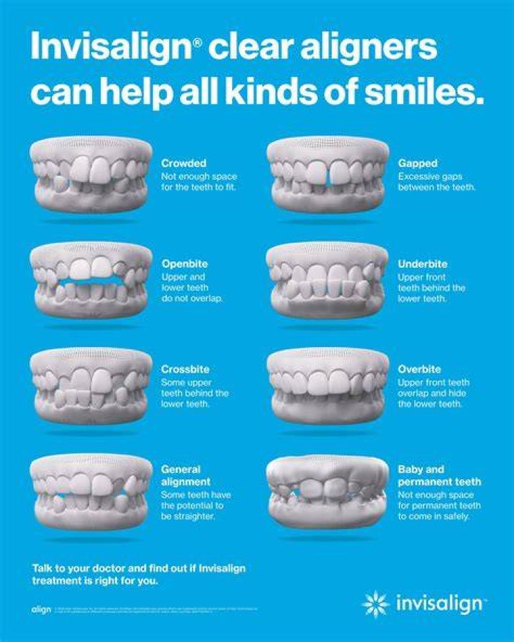 What happens if you swallow an Invisalign attachments?