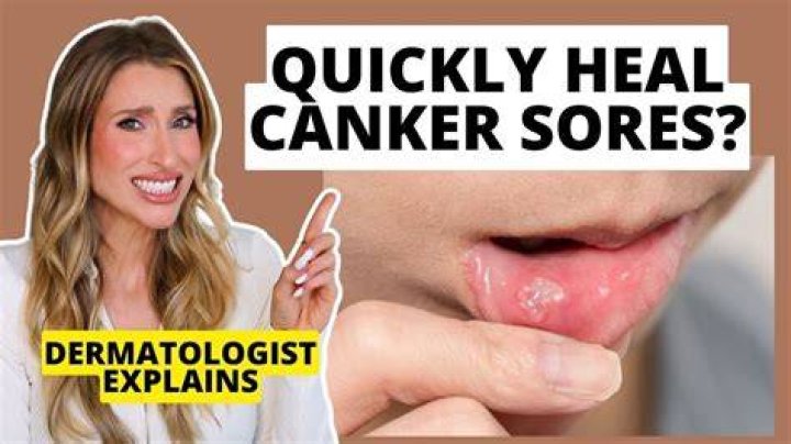 What is canker dog?