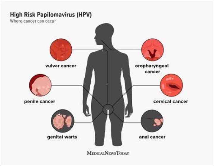 What is high risk HPV?