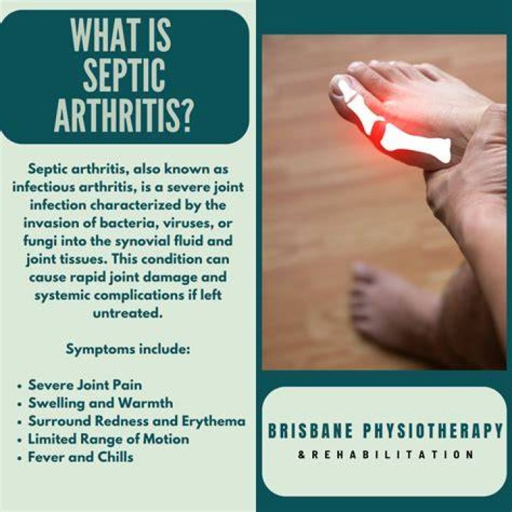 What is septic arthritis?
