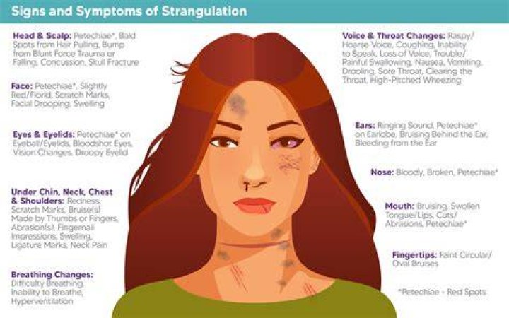 What is strangulation charge?