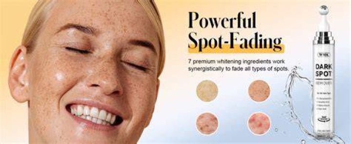 What is the best product to remove age spots on face?