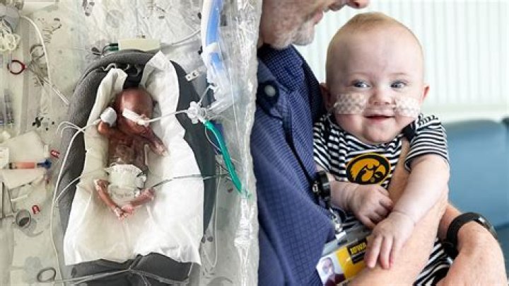 What is the earliest a baby has ever crawled?