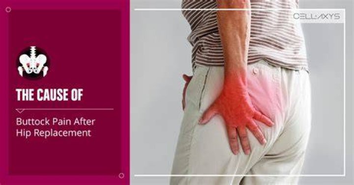 What is the rash between my buttocks?