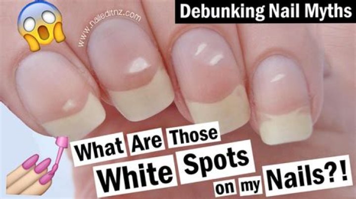 What is the white stuff under my nails when I scratch my scalp?
