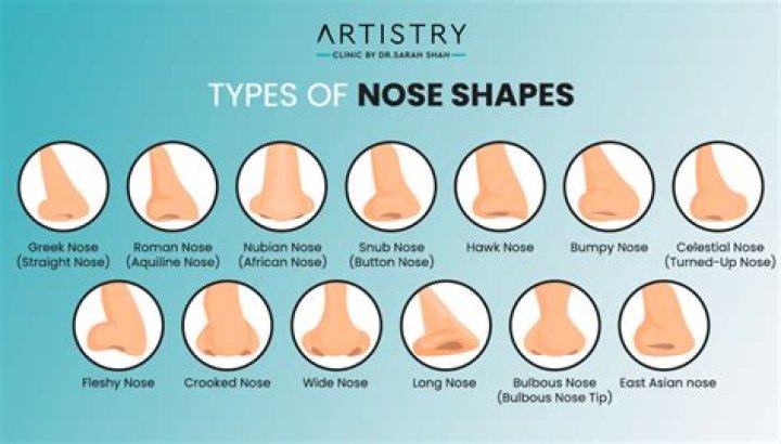 What kind of nose do Latinos have?