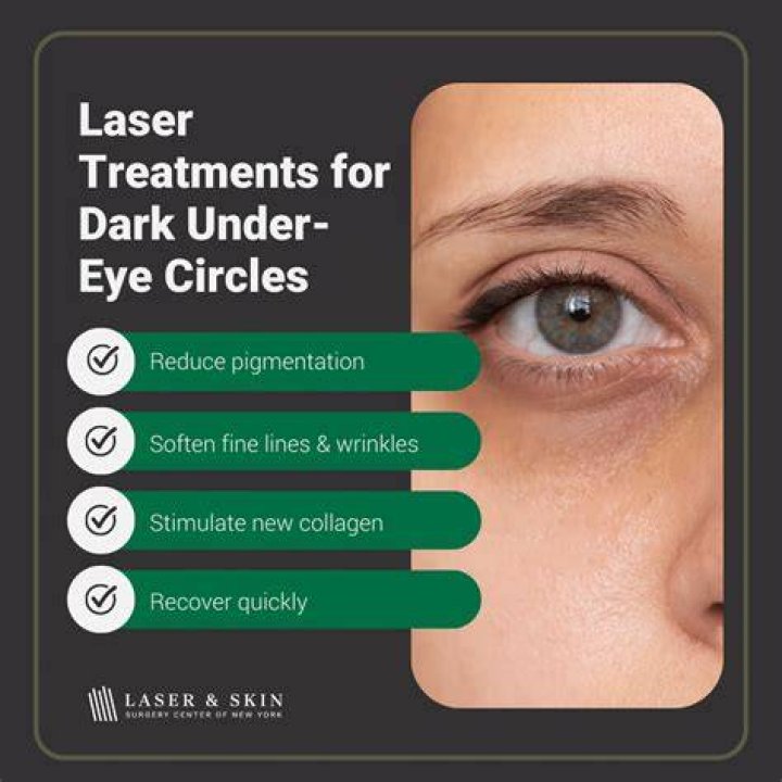 What lightens dark circles under eyes?