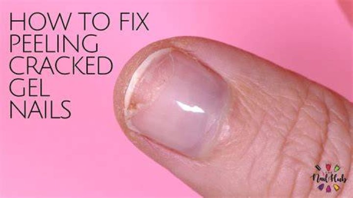 What liquid is used on nails to prevent nails from cracking and peeling?