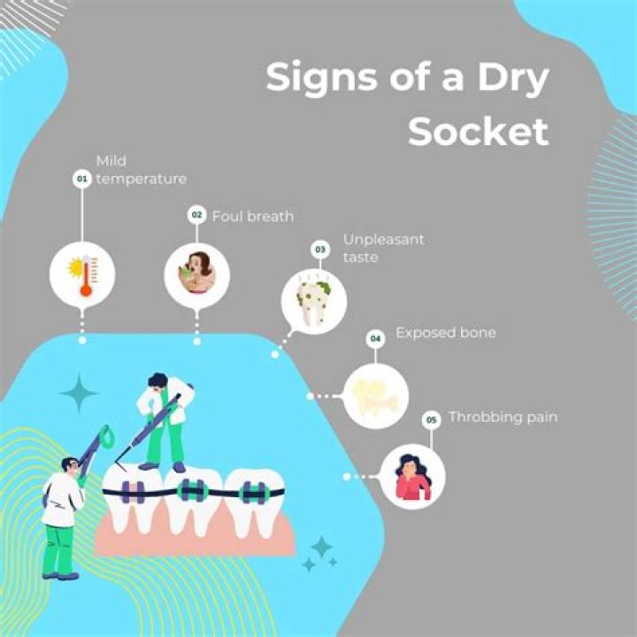 What medication does dentist use for dry socket?